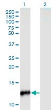 Monoclonal Anti-CYP24A1, (C-terminal) antibody produced