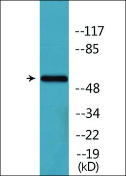 Anti-phospho-Tyrosine Hydroxylase (pSer³¹) antibody produced