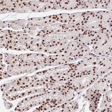 Anti-CCDC12 antibody produced in rabbit