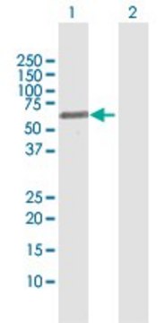 Anti-FSD1 antibody produced in rabbit