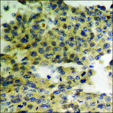 Anti-phospho-HER3 (pTyr¹²??) antibody produced in