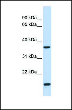 Anti-ZIC4, (N-terminal) antibody produced in