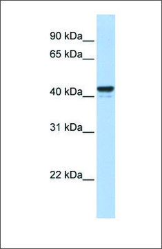 Anti-FOXJ1 antibody produced in rabbit