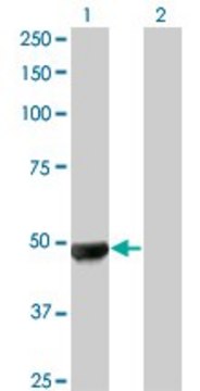 Monoclonal Anti-UBR2, (N-terminal) antibody produced