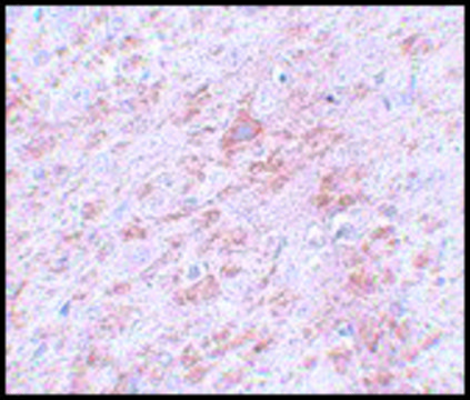 Anti-DCLK2 antibody produced in rabbit