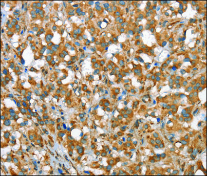 Anti-CSMD1 antibody produced in rabbit