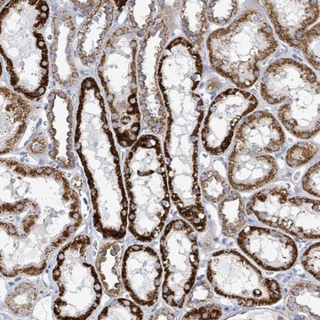 Anti-ALG12 antibody produced in rabbit