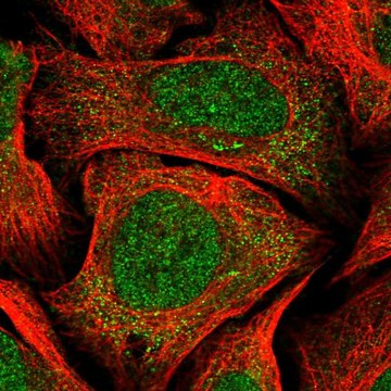 Anti-CCDC138 antibody produced in rabbit