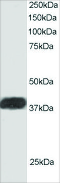 Anti-ALS2CR1/NIF3L1 antibody produced in goat