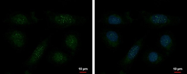 Monoclonal Anti-TERF1 antibody produced in