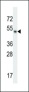 ANTI-MSL1 (CENTER) antibody produced in