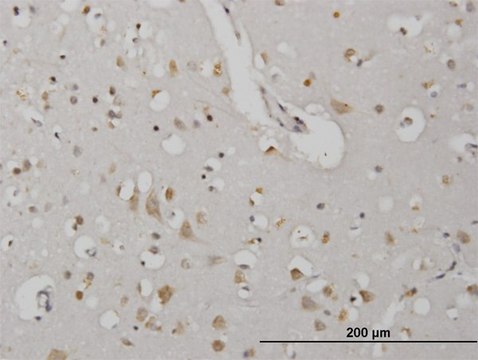 Monoclonal Anti-CDKL2 antibody produced in