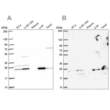 Anti-CMPK1 antibody produced in rabbit