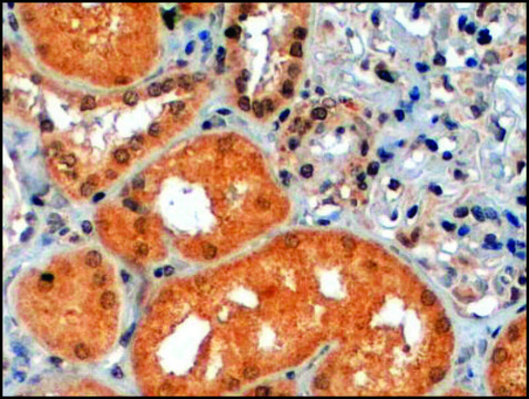 Anti-P70S6K/RPS6KB1 antibody produced in goat