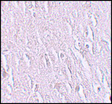 Anti-ZBTB5 antibody produced in rabbit