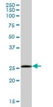 Anti-SSPN antibody produced in mouse