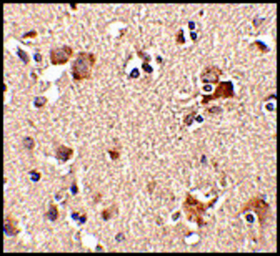 Anti-AIPL1 (ab2) antibody produced in