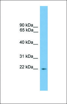 Anti-RGS10, (N-terminal) antibody produced in