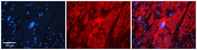Anti-HYAL1 (ab1) antibody produced in