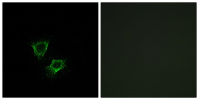 Anti-ZNRF2 antibody produced in rabbit