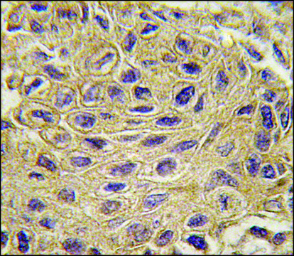 Anti-CTGF (center) antibody produced in