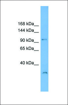 Anti-DENND1A antibody produced in rabbit
