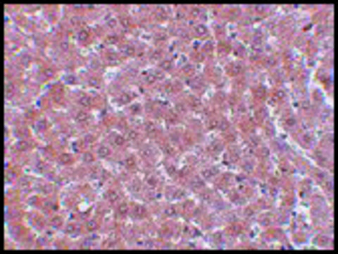 Anti-JMJD2A antibody produced in rabbit