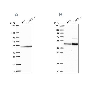 Anti-ARFGAP1 antibody produced in rabbit