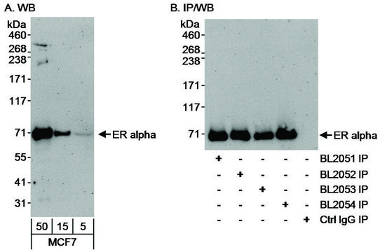 Rabbit anti-Estrogen Receptor Alpha Antibody,