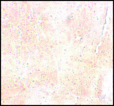 Anti-SYNPO2 antibody produced in rabbit