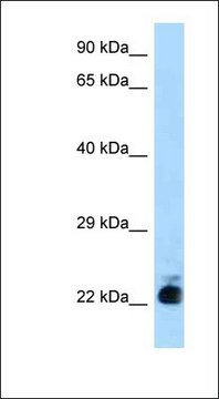 Anti-SLC31A1 antibody produced in rabbit
