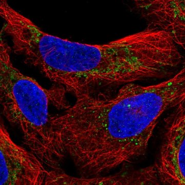 Anti-M1AP antibody produced in rabbit