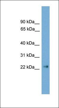 Anti-CLDN6 antibody produced in rabbit