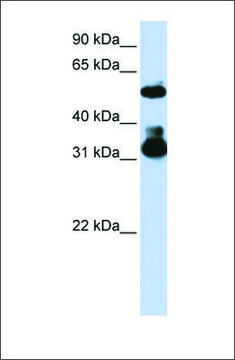 Anti-FBXW2 antibody produced in rabbit