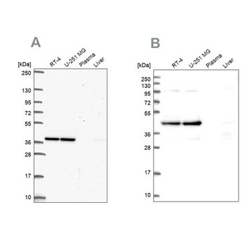 Anti-CCDC94 antibody produced in rabbit