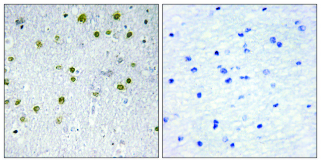 Anti-NRIP2 antibody produced in rabbit