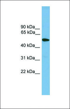 Anti-TMPRSS4 antibody produced in rabbit