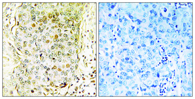 Anti-MLK3 antibody produced in rabbit