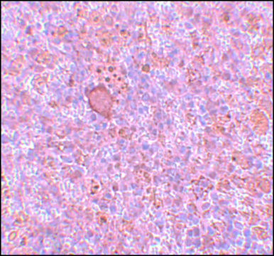 Anti-RBBP8 antibody produced in rabbit