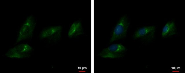 Anti-ENPP2 antibody produced in rabbit