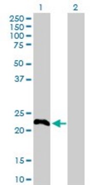 Anti-TSC22D3 antibody produced in rabbit