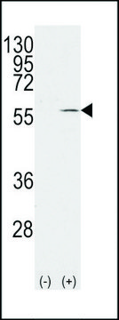 ANTI-VIMENTIN (S82) antibody produced in