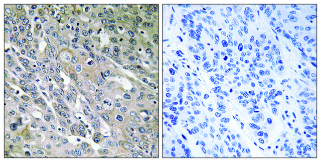 Anti-ARHGEF9 antibody produced in rabbit