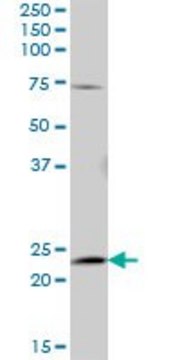 Anti-AK5 antibody produced in mouse