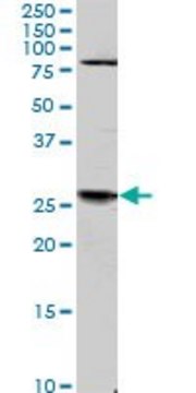 Monoclonal Anti-TGIF2 antibody produced in
