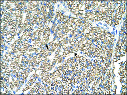 Anti-ATP1B1 antibody produced in rabbit