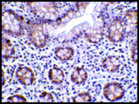 Anti-LSD1 antibody produced in rabbit
