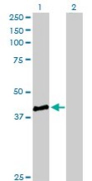 Anti-STBD1 antibody produced in rabbit