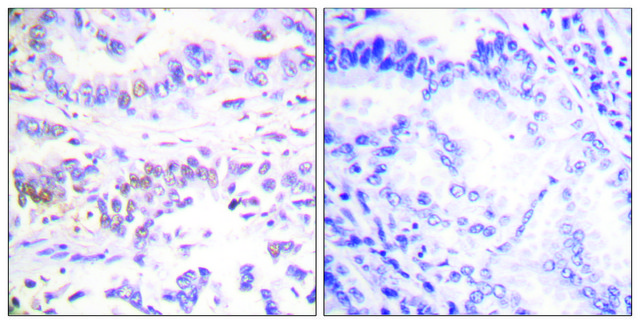 Anti-XRCC3 antibody produced in rabbit