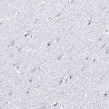 Anti-NOP10 antibody produced in rabbit